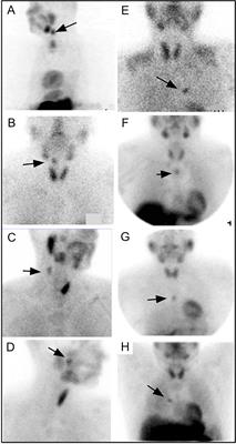 Parathyroid Imaging: Past, Present, and Future